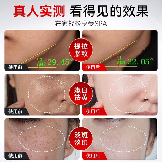 Ou Quanlin Milk Light Beauty Instrument Home Facial Photon Rejuvenation Instrument Blemish Removal Instrument Facial Whitening Gift Super Light Cannon MAX Milk Light + Micro Current Free Care Gift Pack