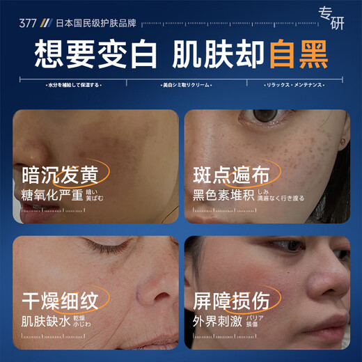 奈皙日本377烟酰胺美白祛斑霜淡化黑色素去雀斑老年黄褐斑面霜男女士