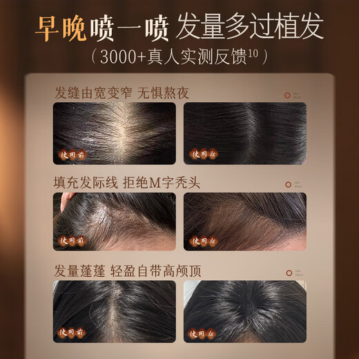 RUYI Anti Hair Loss Hair Growth Essence 100ml Hair Firming Hair Growth Agent Activates Hair Follicles to Increase Hair Loss and Thick Hair Growth Essence