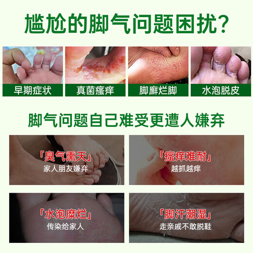 Yunnan herbal athlete's foot, smelly feet, itchy peeling feet, fungal infection spray 60ml + cream 20g skin antibacterial agent set
