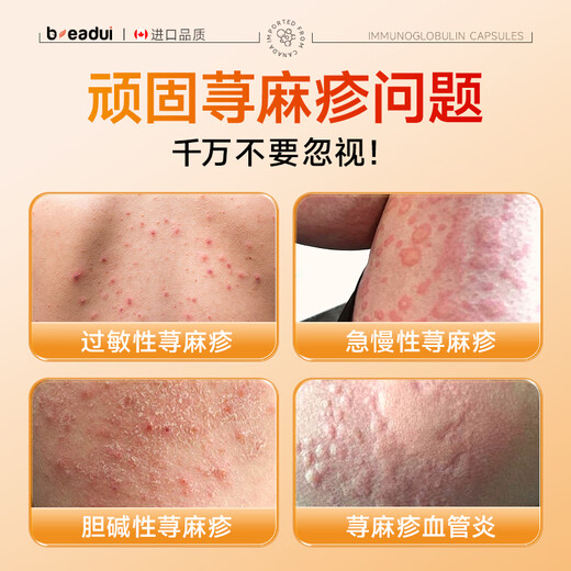 Beadui Immunoglobulin imported beadui immune globulin bovine colostrum to enhance physical fitness three bottles (95% of customers choose the cycle pack)