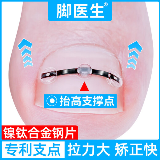 Foot doctor foot fixator, paronychia corrector, ingrown toenail special nail patch, toenail long flesh