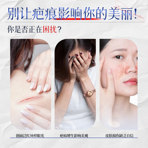 Jiubu Pharmaceutical scar patch, caesarean section scar removal, special repair medical silicone gel, surgical hyperplasia bump removal, 3 boxes