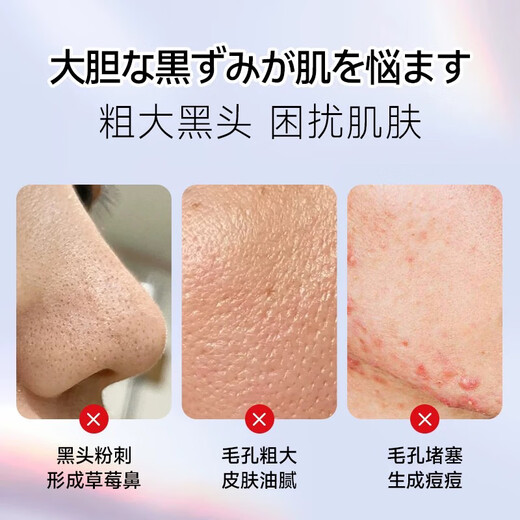 DIKTT Germany blackhead scraper, ultrasonic blackhead remover, electric acne scraper, blackhead suction tool, beauty instrument, pore cleaning, super suction to remove dead skin, gift for girlfriend, Haoyuebai, ultrasonic vibration + EMS firming + blackhead removal