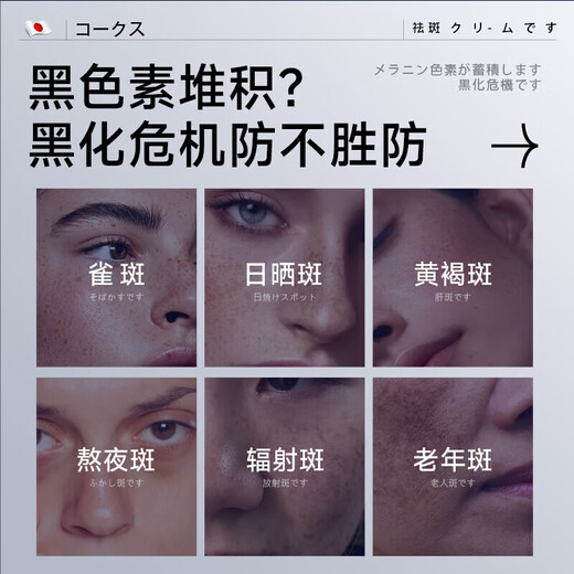 Dr. Jiao Japan 377 freckle cream whitening and lightening aged brown freckles melanin arbutin cream to remove sunburn for men and women