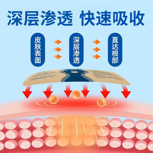 Tramamadol analgesic cancer pain relief sustained-release tablets imported paracetamol hydrochloride late stage cancer pain relief three boxes of severe pain