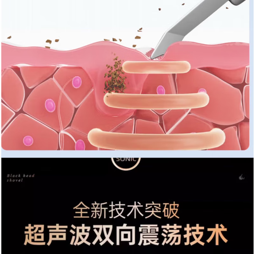 Xiaomi 2025 new blackhead shovel removes blackheads and cleans artifacts, ultrasonic beauty instrument, skin shovel machine, pore cleaning instrument, ultrasonic blackhead instrument, standard version
