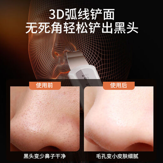 KONKA ultrasonic peeling machine, electric blackhead shovel, blackhead remover, facial acne pore cleaning beauty instrument, tail cargo machine, ordinary model, battery model, vibration cleaning