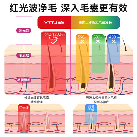 VTT Germany Hair Removal Device Freezing Point Household Laser Full Body Hair Removal Medical Sapphire Hair Removal Device Private Part Shaving Legs Armpit Lip Stone Painless Ice Feeling Birthday Gift for Girlfriend Green Pine Green Full Wave Light Root Quick Removal Accelerating Light Extraction/Thick Hair Follicles/No Black Leaves
