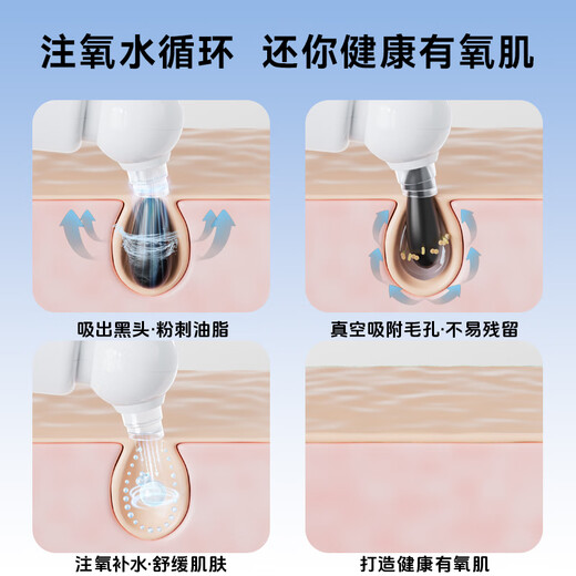 AUX blackhead suction instrument, special small bubbles for beauty salons, household large suction electric cleaner, pore cleaning and hydration, facial blackhead cleaning, acne removal tool, beauty instrument, fully equipped with hot compress model, gentle water suction + four-speed mode + deep cleaning AUX X20 small bubbles (A white)