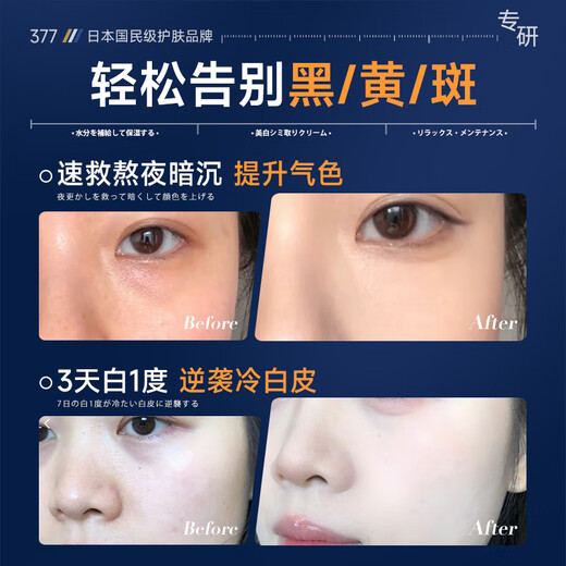 奈皙日本377烟酰胺美白祛斑霜淡化黑色素去雀斑老年黄褐斑面霜男女士