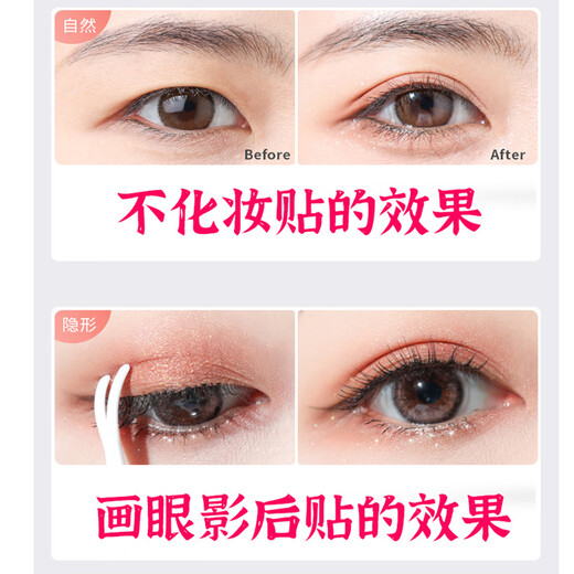 Miss Youya special eyelid lifting patch for middle-aged and elderly people, a magic device for relaxing eye muscles, weak eye size correction patch, invisible eyelid lifting patch for men and women, drooping eyelid lifting 200 patches, delivery, watering bottle + tweezers/tools