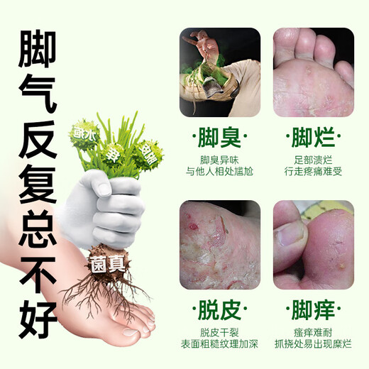 Yunnan herbal athlete's foot, smelly feet, itchy peeling feet, fungal infection spray 60ml + cream 20g skin antibacterial agent set