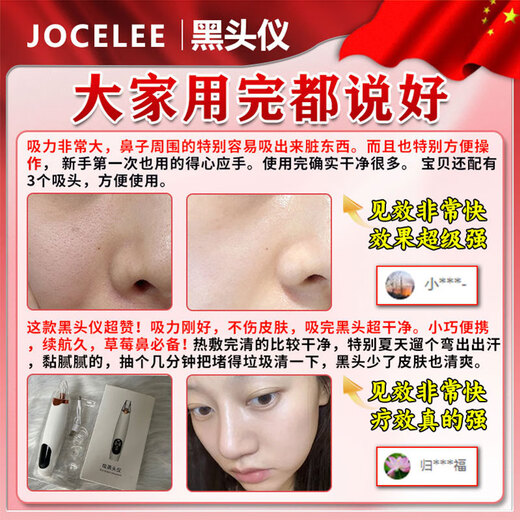 Qiaocheng blackhead suction instrument cleaner beauty salon special household large suction blackhead acne cleaning artifact for men and women white standard model vacuum negative pressure / suck out blackheads