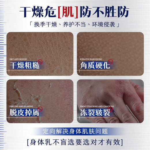 DAGO Urea Cream Medical Urea Hand Cream Vitamin E Cream for Men and Women Big Brand Large Capacity Cracked Hands and Feet + Moisturizing Cream