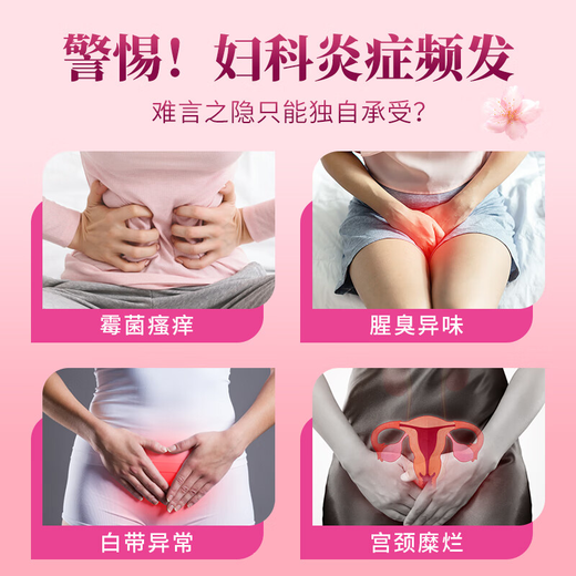 MEROYDOCTOR gynecological gel for private parts, special smell, cervicitis, gynecological inflammation, vaginitis, leucorrhea, vulvar itching, relief of itching