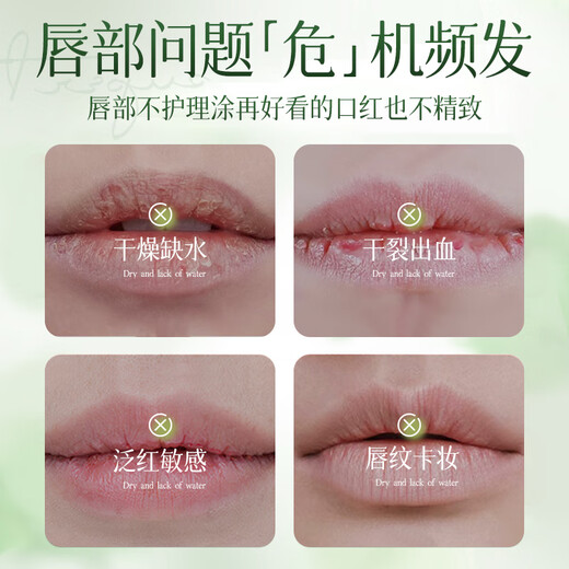 Ehmznv Vaseline double moisturizing women's moisturizing anti-drying peeling colorless non-greasy students men and women can use Vaseline lip balm 3 pieces