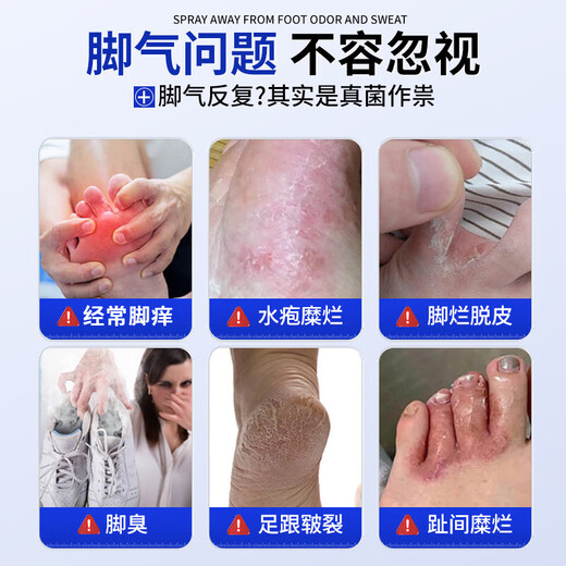 Layanana athlete's foot spray to relieve itching, peeling, rotten feet, fungal infection, smelly feet, itchy feet, improve foot antibacterial spray 60ML