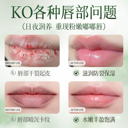 Ehmznv Vaseline double moisturizing women's moisturizing anti-drying peeling colorless non-greasy students men and women can use Vaseline lip balm 3 pieces