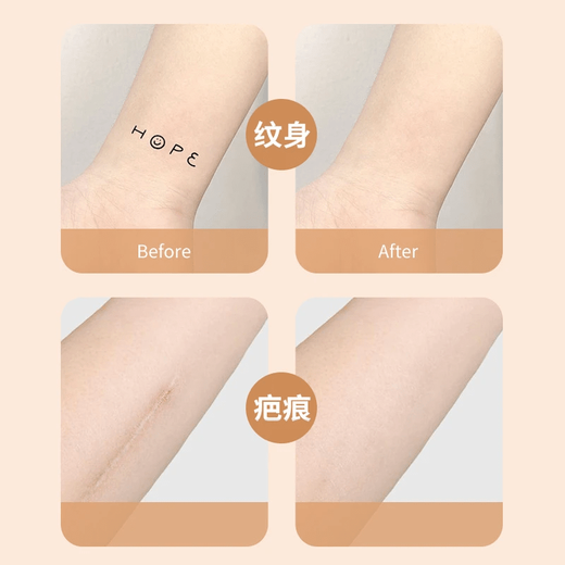 Japanese tattoo cover-up scar cover invisible artifact flesh-colored birthmark scar waterproof natural concealer patch popular skin color 8 photos