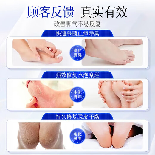 Layanana athlete's foot spray to relieve itching, peeling, rotten feet, fungal infection, smelly feet, itchy feet, improve foot antibacterial spray 60ML