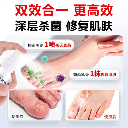 Tongrentang athlete's foot spray to relieve itching, peeling, rotten feet, fungal infection, sweaty feet, foot odor and blisters, special spray to treat wolfsbane spray