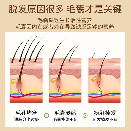 Tongrentang anti-hair loss, hair strengthening, hair growth and dense hair shampoo, polygonum multiflorum and ginger shampoo, shampoo for men and women.