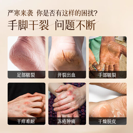 Qingzitang horse oil anti-cracking cream for cracked hands and feet horse oil cream for cracked feet and heels moisturizing moisturizing cream 35g