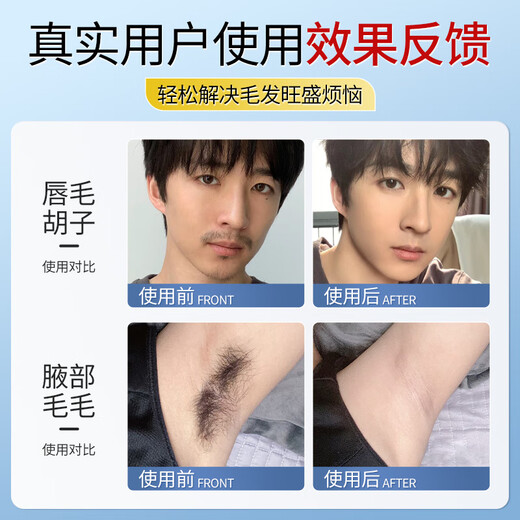 Keda Biological Hair Removal Cream for Men's Lips, Mustache, Full Face, Private Parts, Armpits, Legs, and Whole Body YQ6 White