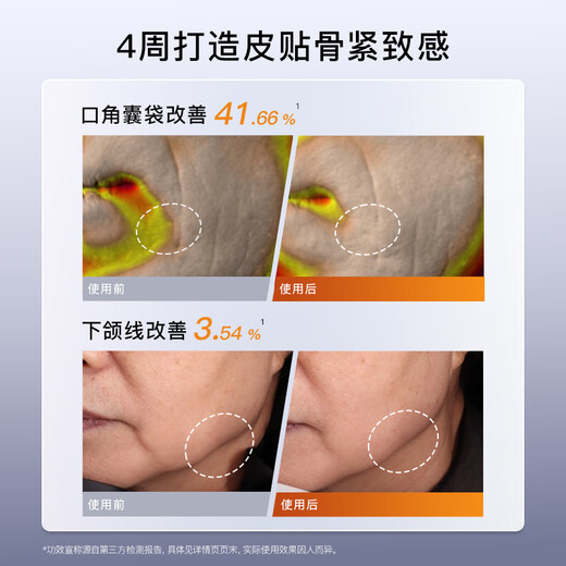 Yameng Golden V Face Instrument LIFT Home Beauty Instrument Firms and Smoothes Skin, Gift to Girlfriend on Her Birthday, Same Style as Li Jiaqi