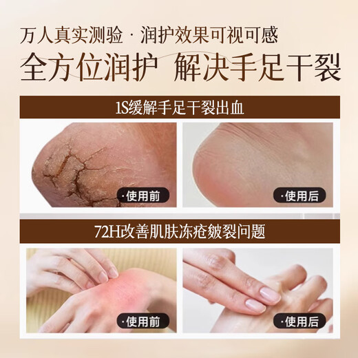 Qingzitang horse oil anti-cracking cream for cracked hands and feet horse oil cream for cracked feet and heels moisturizing moisturizing cream 35g