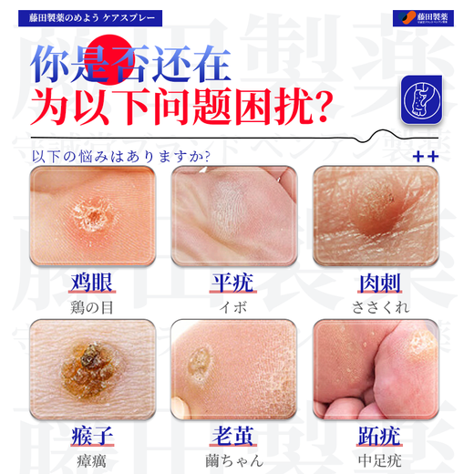 Fujita Pharmaceutical Japanese Corn Patch to remove painless fleshy thorns and remove plantar warts and sole toe warts by the roots 1 box