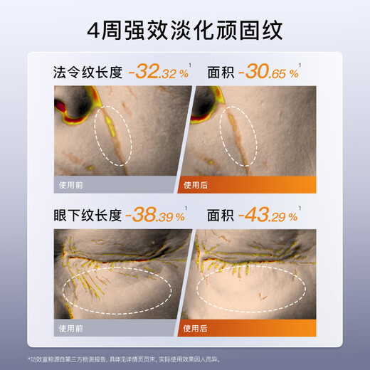 Yameng Golden V Face Instrument LIFT Home Beauty Instrument Firms and Smoothes Skin, Gift to Girlfriend on Her Birthday, Same Style as Li Jiaqi