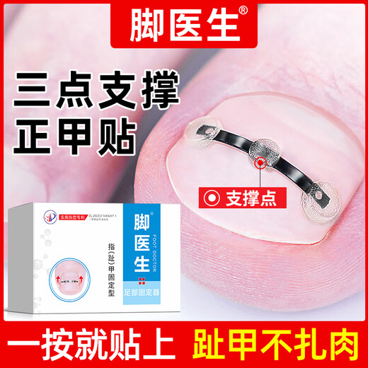 Foot doctor foot fixator, paronychia corrector, ingrown toenail special nail patch, toenail long flesh