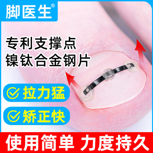 Foot doctor foot fixator, paronychia corrector, ingrown toenail special nail patch, toenail long flesh