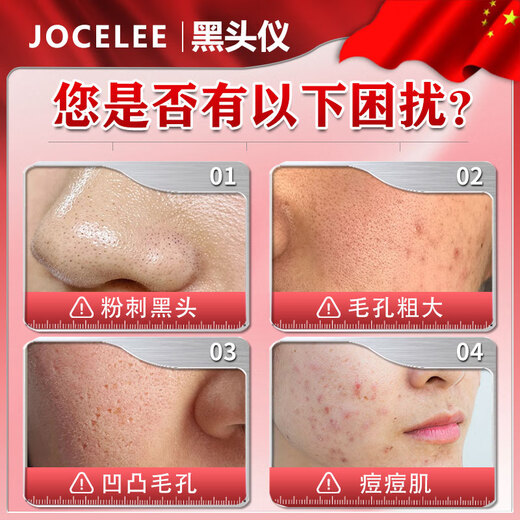 Qiaocheng blackhead suction instrument cleaner beauty salon special household large suction blackhead acne cleaning artifact for men and women white standard model vacuum negative pressure / suck out blackheads