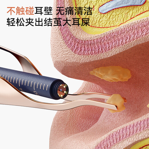 Shantou Lincun visual ear scoop high-definition ear scoop with tweezers, ear scoop tool, ear endoscopy tool, earwax cleaning tool, off-white, 17 accessories + storage box