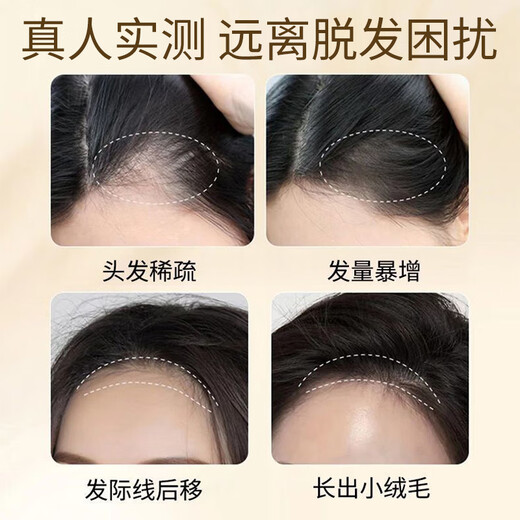 Tongrentang anti-hair loss, hair strengthening, hair growth and dense hair shampoo, polygonum multiflorum and ginger shampoo, shampoo for men and women.