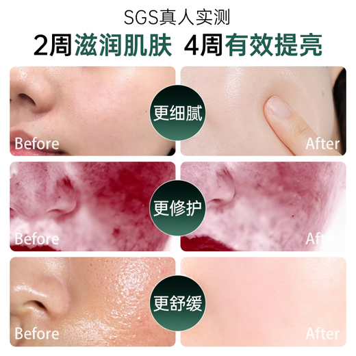 Ou Quanlin oxygen injection instrument high-pressure nano spray hydration instrument household steam facial beauty instrument essence introduction nano water light instrument