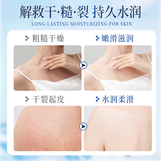 Qianzhilin Vaseline Fruit Acid Body Lotion for Women Anti-chapped, Hydrating and Moisturizing to Improve Dryness and Rough Fragrance Autumn and Winter Whole Body Vaseline Fruit Acid Body Lotion 400gx1 bottle (1 bottle of aloe vera gel included)