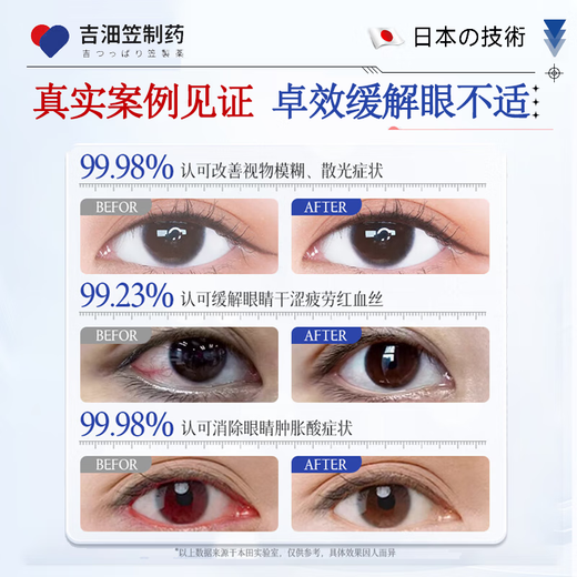 Jili Pharmaceutical Japanese Lutein Eye Drops relieve eye fatigue, dry eyes, blurred vision, relieve itching, swelling and pain, stay up late and reduce inflammation