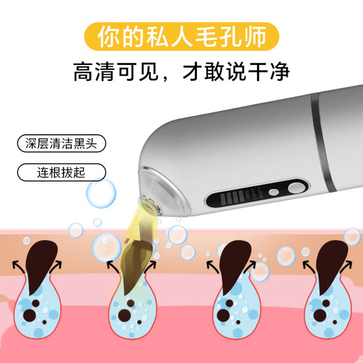 OENUXCRA Blackhead Absorbing Instrument for Men and Women, Blackhead Absorbing Instrument, Blackhead Absorbing Instrument, Acne Pore Cleaning Instrument, Facial Acne Absorbing Beauty Instrument, Pore Vacuum Cleaner on Fingertips