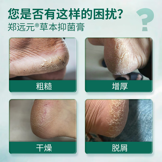 Zheng Yuanyuan's Tailuo antibacterial cream, skin antibacterial cream, cracked foot peeling herbal antibacterial cream, official flagship store authentic product, store same style Tailuo herbal antibacterial cream (free foot soap)