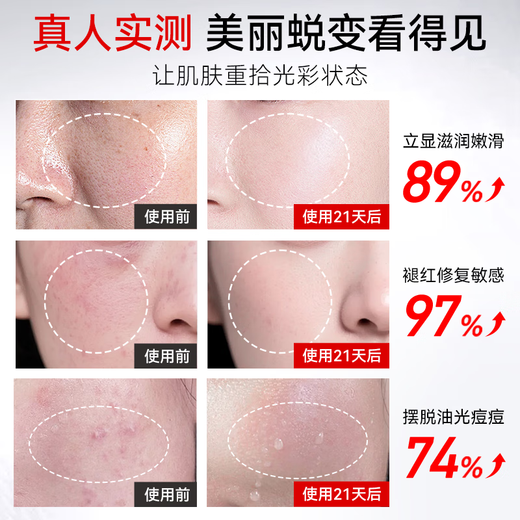 Ou Quanlin vaporizador facial pulverizador instrumento de belleza hidratante facial humectante hogar nano facial compresa caliente spray caliente vapor facial