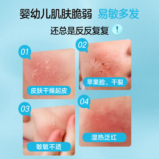 Niuqiang Children's Face Cream Four Seasons Moisturizing Anti-Dry Redness Body Lotion Infant Moisturizing Moisturizing Essence Milk 200g