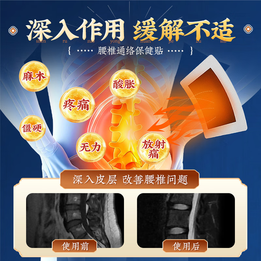 Huang Xixiang's lumbar disc herniation plaster compresses nerves, lower back pain, butt pain, lumbar muscle strain, lumbar disc special patch 3 boxes