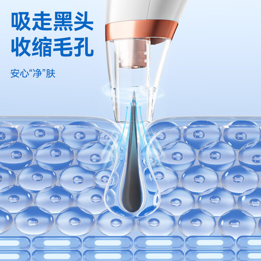 AUX blackhead instrument blackhead extractor removes blackheads and cleans the artifact spatula for facial blackhead suction and acne cleaning small bubble beauty instrument birthday and New Year gift for girls