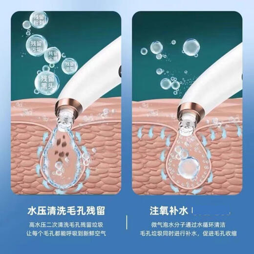 HYUNDAI small bubble blackhead suction device electric large suction beauty salon men's special blackhead suction device cleaning artifact New Year's Day holiday gift for boys and girls gift bag model - oxygenated water circulation - suction and hydration - sparkling water
