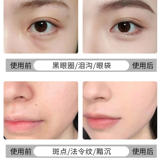 NARS Concealer 6ml Dark Circles, Acne Marks, Spots, Redness, Tear Troughs, Brightening, No Sticky Lines, Medium Sample #Custard Custard 1.4ml, Medium Sample