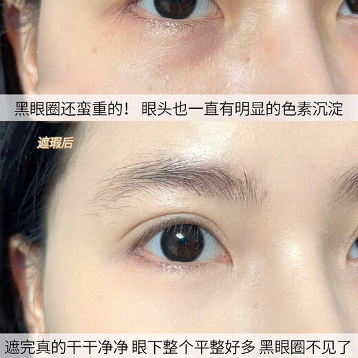 NARS Concealer 6ml Dark Circles, Acne Marks, Spots, Redness, Tear Troughs, Brightening, No Sticky Lines, Medium Sample #Custard Custard 1.4ml, Medium Sample